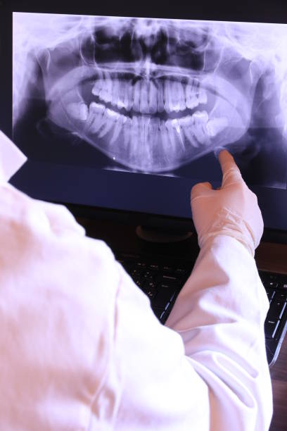 Best Urgent Care for Lost Fillings or Crowns in Sumner, WA