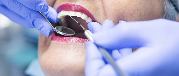 Best Emergency Treatment for Dental Infections or Abscesses in Sumner, WA